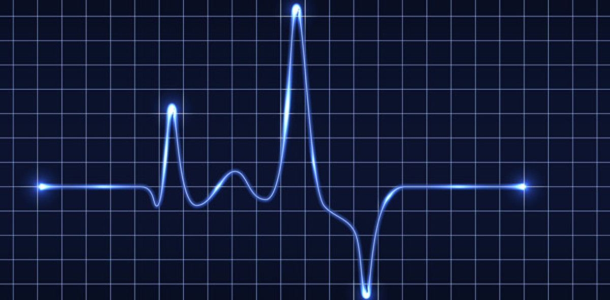 Inflationäre Rezession: „Ein großer Stresstest für die Weltwirtschaft” Bild: Marina Tikhoplav